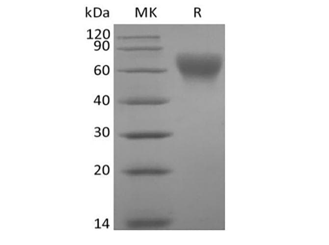 Human CD86 Protein (Recombinant AVI-6His, C-terminus)