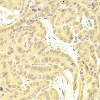 CFLAR / FLIP Antibody