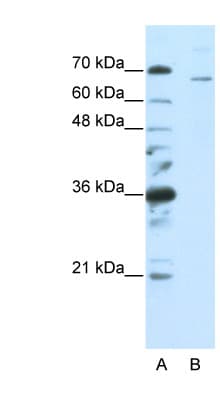 Polyclonal Rabbit anti-Human SF1 Antibody (aa517-566, IHC, WB)