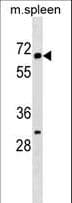 KLHL22 Antibody (aa586-614)