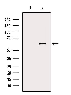 Polyclonal Rabbit anti-Human DPYSL5 / CRMP5 Antibody (IF, WB)