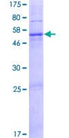 Human DNAJC22 / FLJ13236 Protein (Recombinant GST)