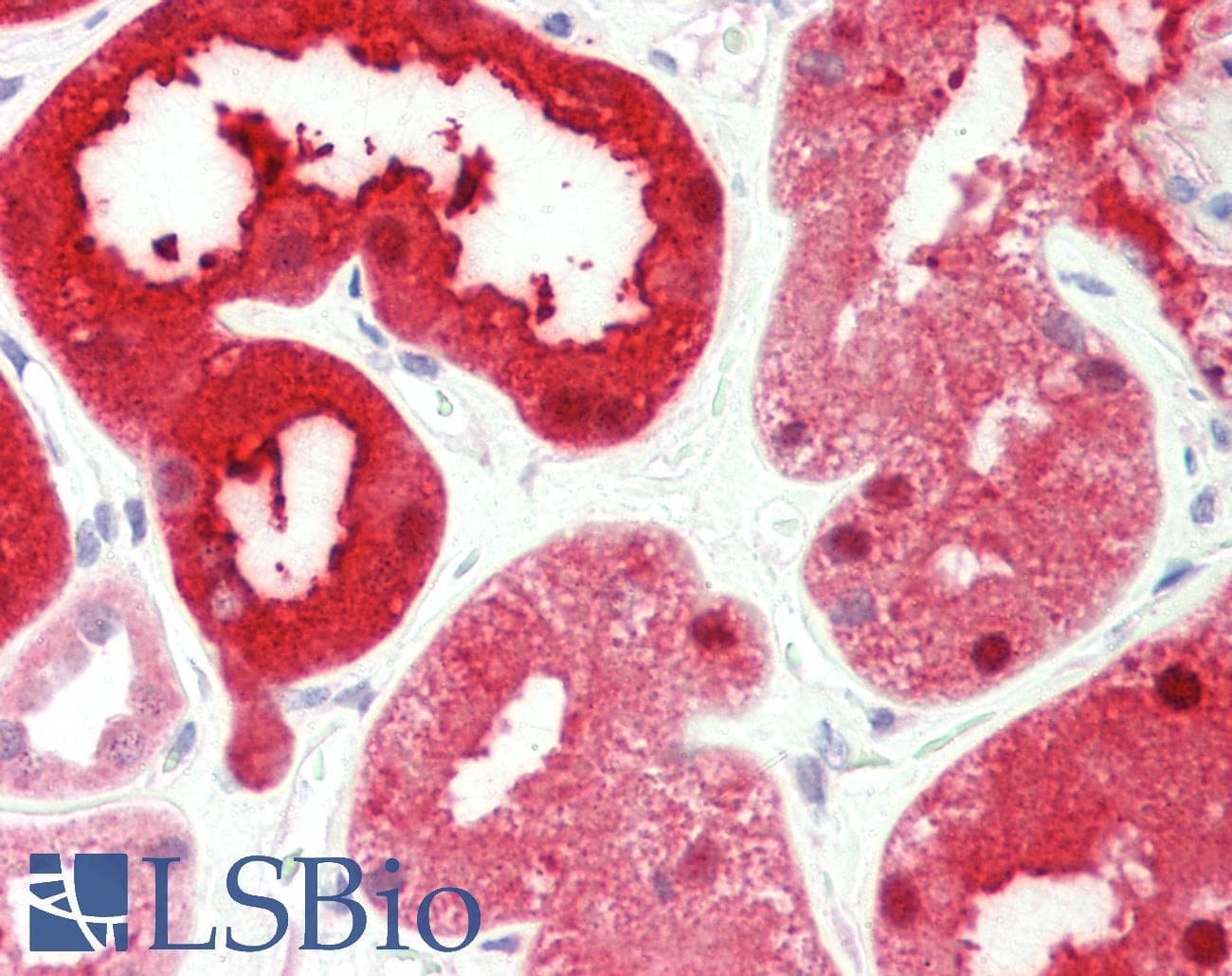 IHC-plus™ Polyclonal Rabbit anti-Human PSAT1 Antibody (aa48-328, IHC, WB)