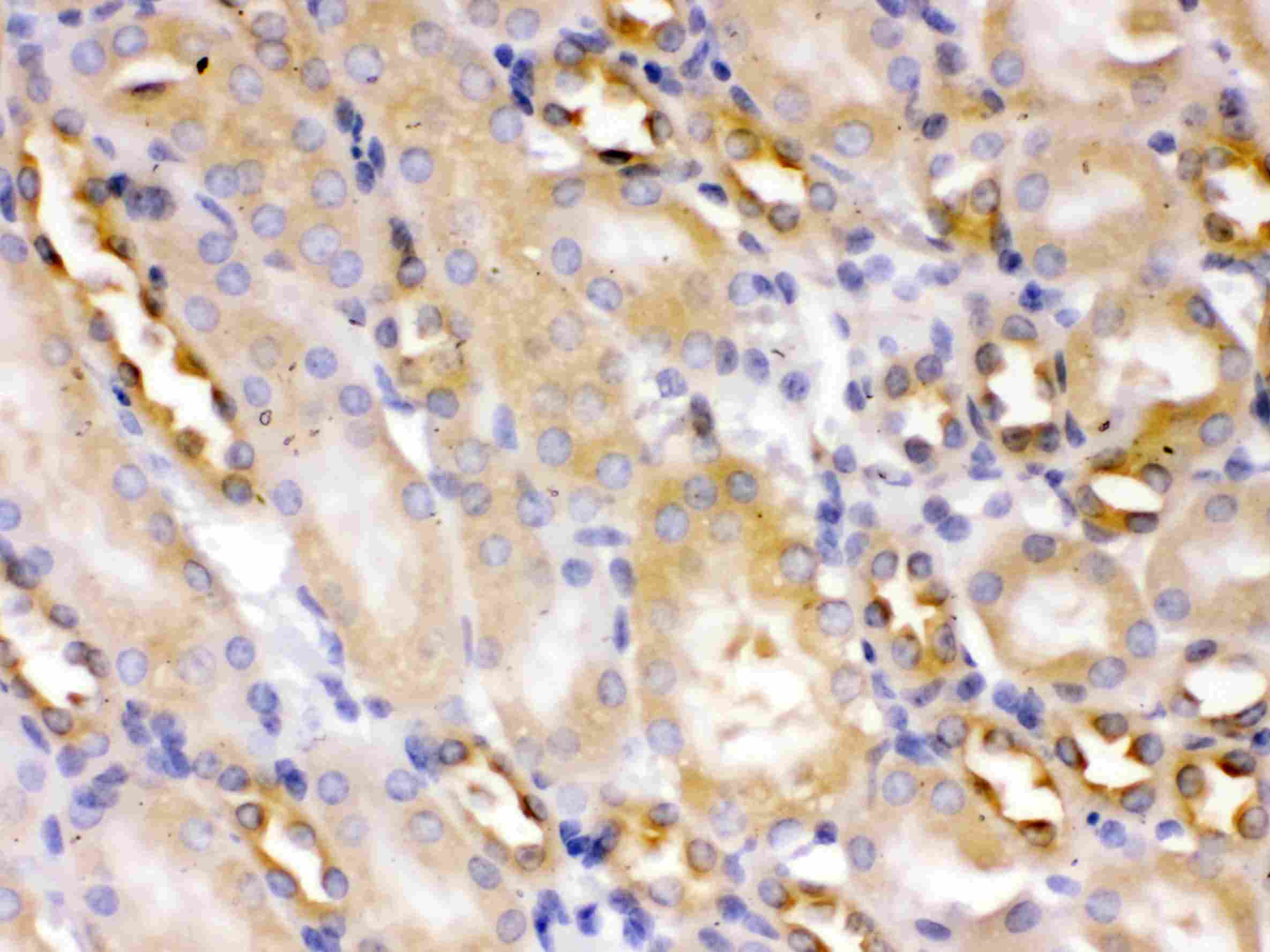 ACTN4 Antibody
