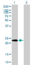 Monoclonal Mouse anti-Human PTTG1IP / PBF Antibody (clone 4C11, IF, WB)