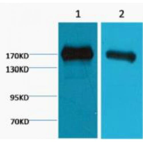 Monoclonal Mouse anti-Human EGFR Antibody (clone M6, WB)