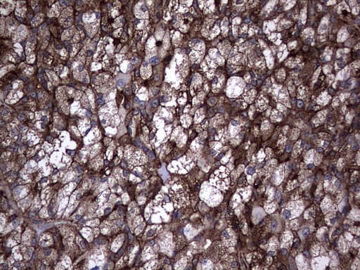 Monoclonal Mouse anti-Human TG / Thyroglobulin Antibody (clone OTI1F1, aa20-358, IHC, WB)