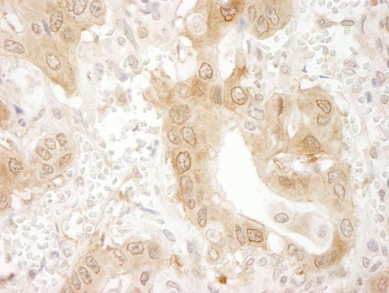 PXN / Paxillin Antibody (aa1-50)