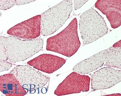 IHC-plus™ Polyclonal Rabbit anti-Human TPM1 / Tropomyosin Antibody (IHC, IF, WB)