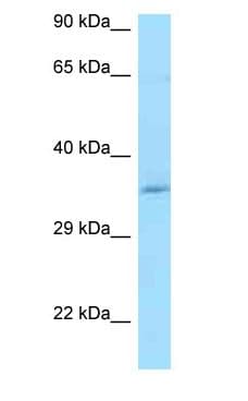 CCDC117 Antibody (aa119-168)