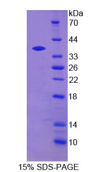 Rat NCAN / Neurocan Protein (Recombinant His, N-terminus)