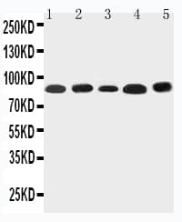 Polyclonal Rabbit anti-Human NOX5 Antibody (aa747-765, IHC, WB)