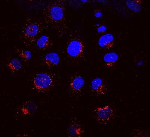 IHC-plus™ KDELR / KDEL Receptor Antibody (clone KR-10)