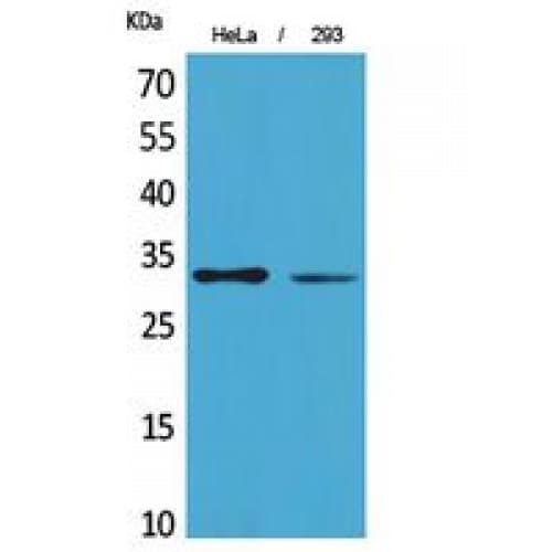 SDHB Antibody (121-170 aa, Internal)