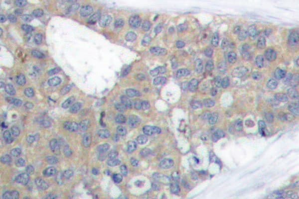 Polyclonal Rabbit anti-Human PXN / Paxillin Antibody (Leu25, IHC, IF, WB)