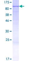 Human LCA3 / SPATA7 Protein (Recombinant GST)