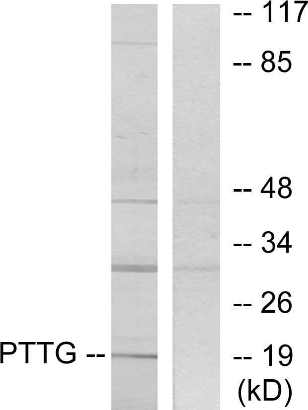 IHC-plus™ Polyclonal Rabbit anti-Human PTTG1IP / PBF Antibody (aa116-165, IHC, WB)