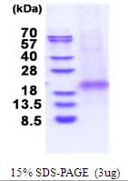 Human XAF1 Protein (Recombinant His)