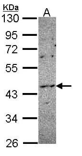 IHC-plus™ Polyclonal Rabbit anti-Human NOXO1 Antibody (C-Terminus, IHC, WB)