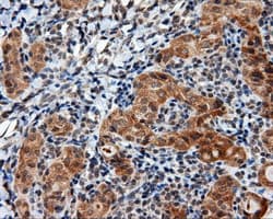 LIPG / Endothelial Lipase Antibody (clone OTI6E11)