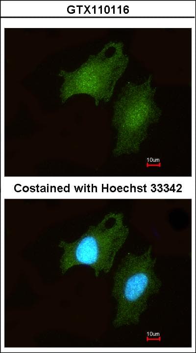 DIP2B Antibody (aa1168-1427)