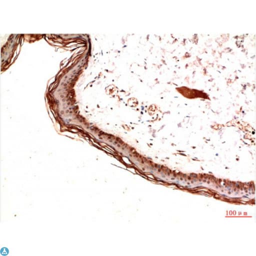 PDGFRA / PDGFR Alpha Antibody