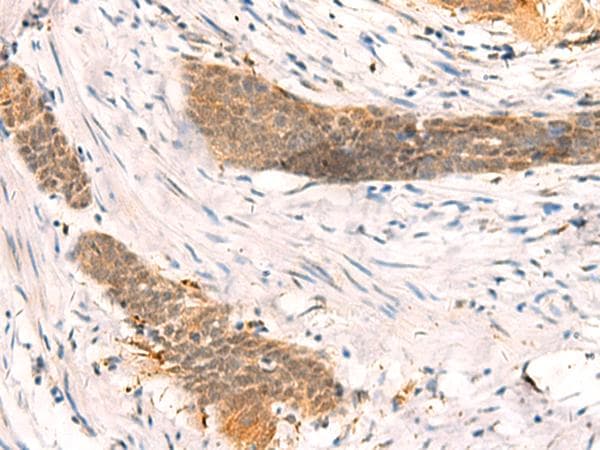 SETD1A / SET1 Antibody