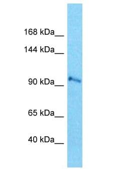 Polyclonal Rabbit anti-Human SEC24C Antibody (aa262-311, WB)