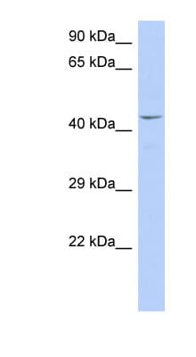 Polyclonal Rabbit anti-Human TAF7 Antibody (C-Terminus, WB)