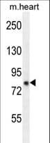 ZFYVE28 Antibody (aa604-633)