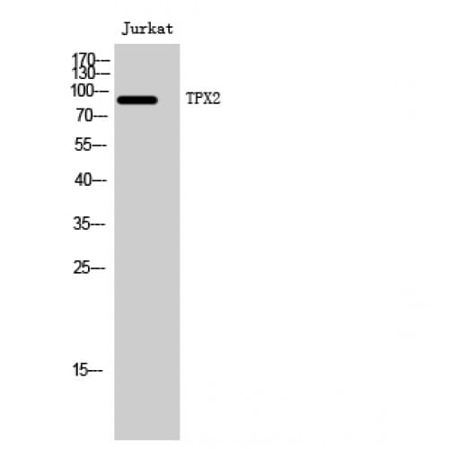 Polyclonal Rabbit anti-Human TPX2 Antibody (270-350 aa, Internal, IHC, WB)