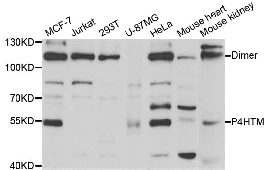 Polyclonal Rabbit anti-Human PH4 / P4HTM Antibody (IHC, IF, WB)