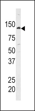 Polyclonal Rabbit anti-Human HK1 / Hexokinase 1 Antibody (aa705-734, IHC, WB)