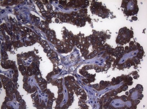 MAK Antibody (aa291-623, clone OTI5A7)