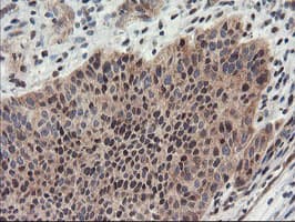 PSMA4 Antibody (clone OTI1H10)