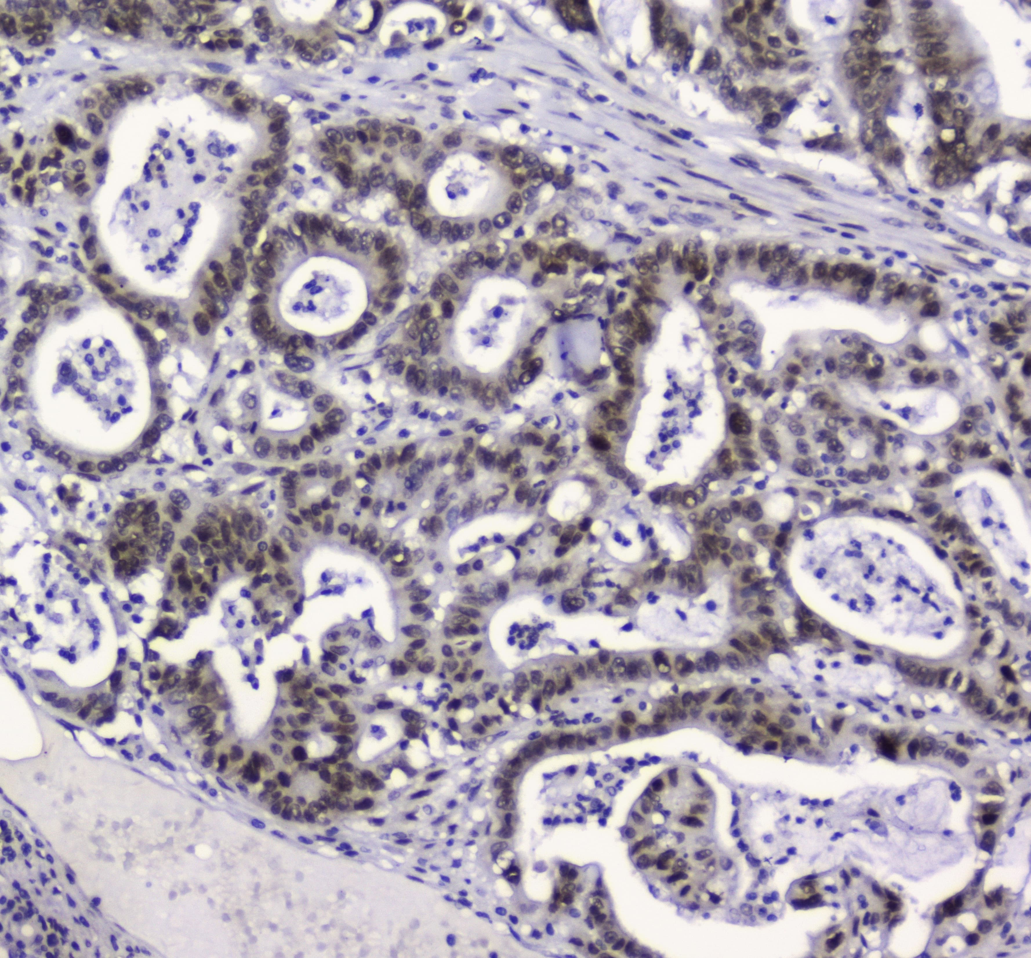 APEX1 / APE1 Antibody