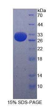 Mouse ITGAE / CD103 Protein (Recombinant His, N-Terminal)