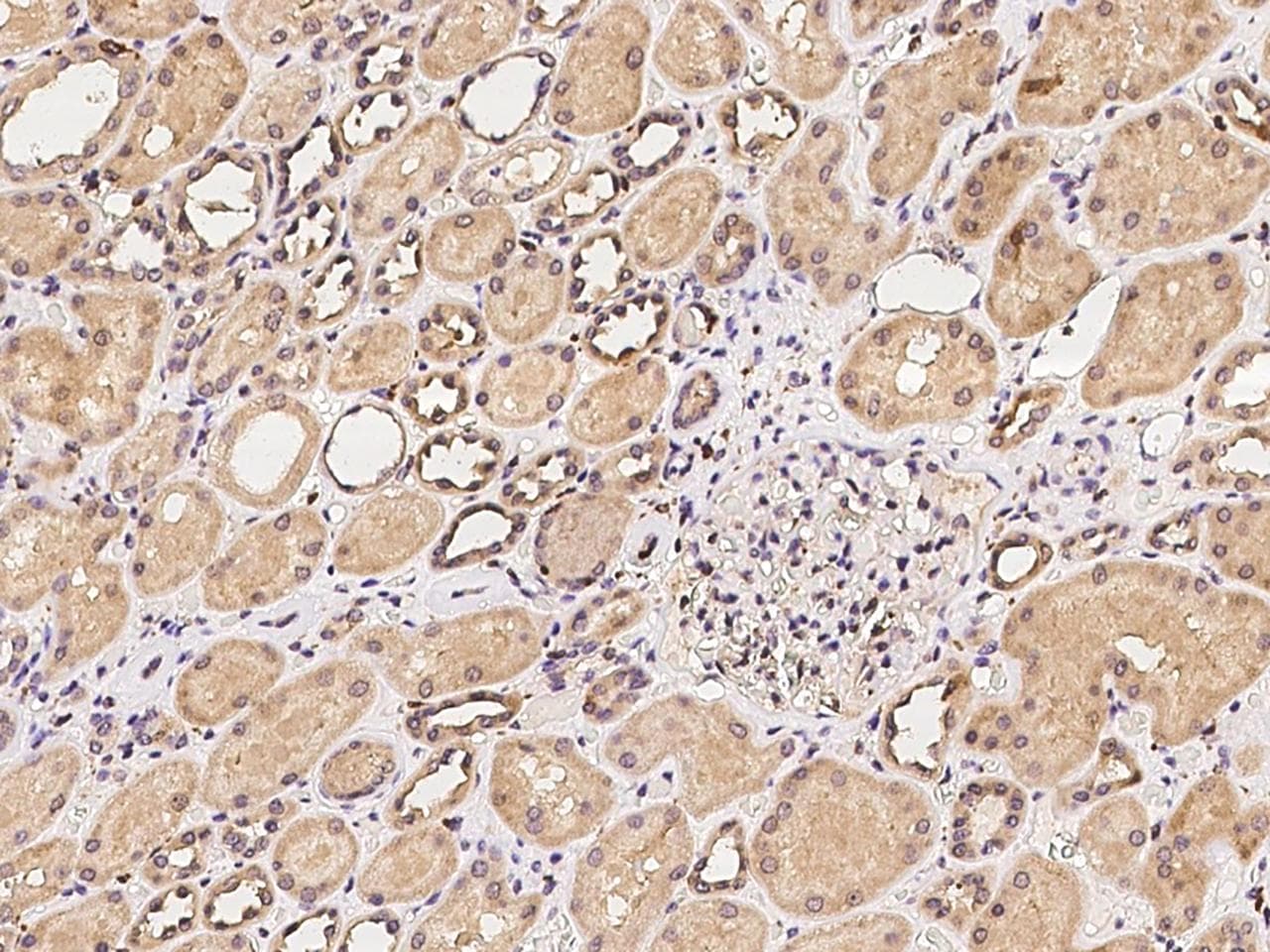 CSGALNACT2 Antibody