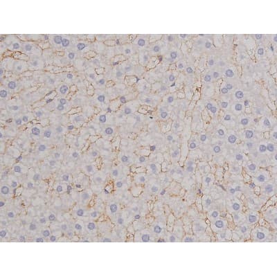 FAK / Focal Adhesion Kinase Antibody (phospho-Tyr576)