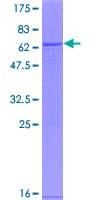 Human MNAT1 Protein (Recombinant GST)