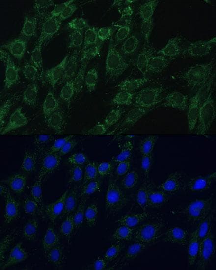 Polyclonal Rabbit anti-Human ACLP / AEBP1 Antibody (IF)