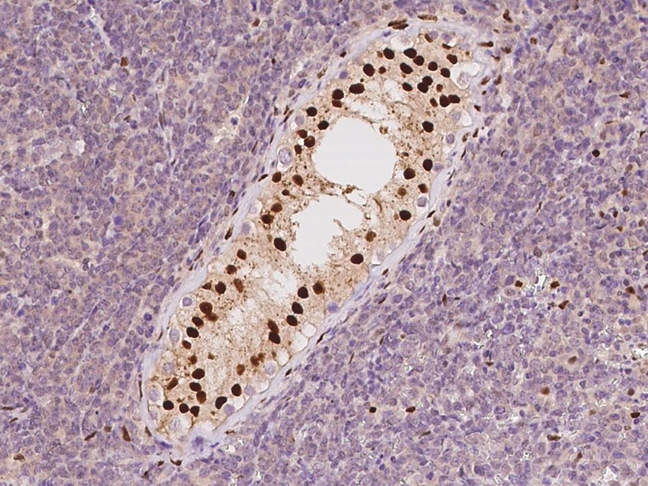 Polyclonal Rabbit anti-Human TCEAL3 Antibody (IHC, WB)