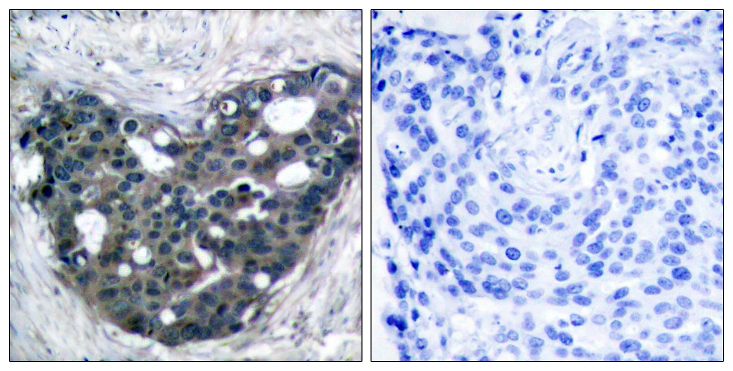 DOK2 Antibody (aa266-315)