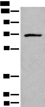 ADGRE3 / EMR3 Antibody