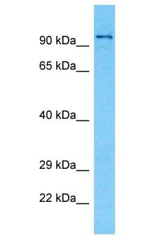 TGFBRAP1 / TRAP-1 Antibody (aa561-610)