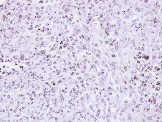 ZNF707 Antibody (aa121-371)