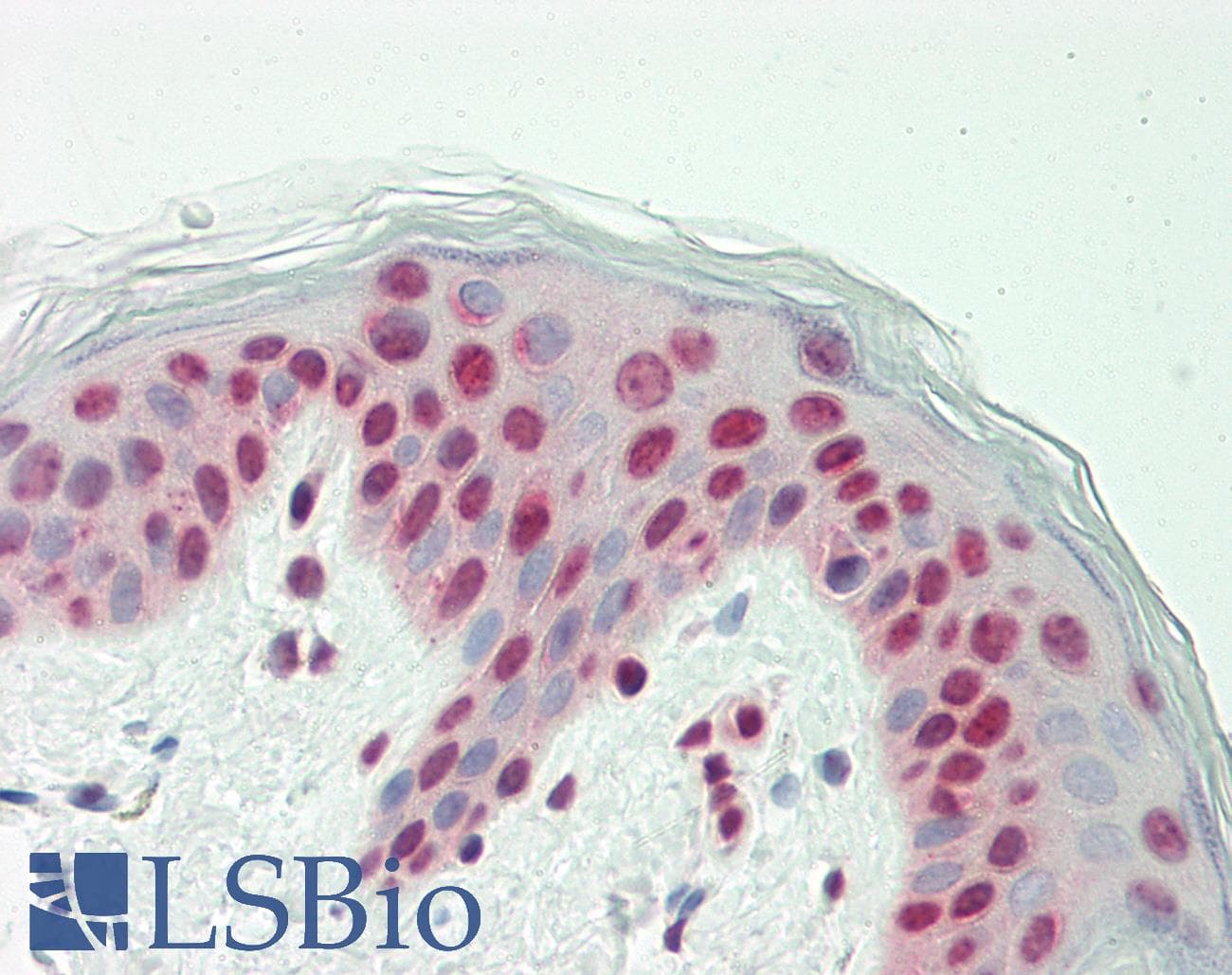IHC-plus™ RAF1 / RAF Antibody (aa86-113)