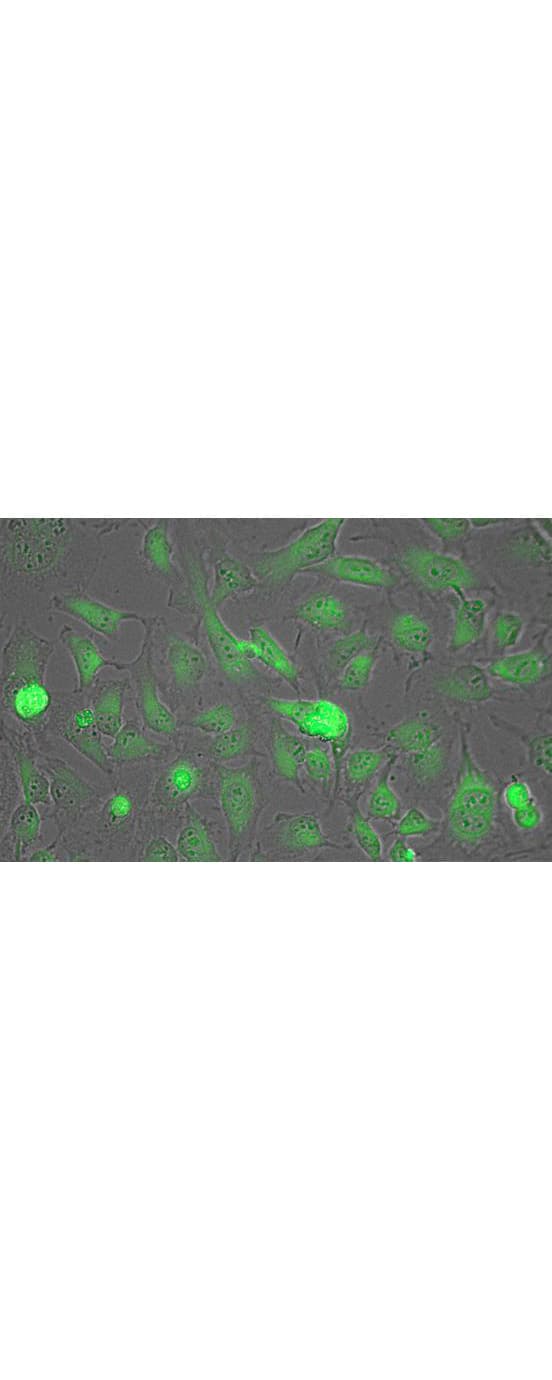 LDH / Lactate Dehydrogenase Antibody