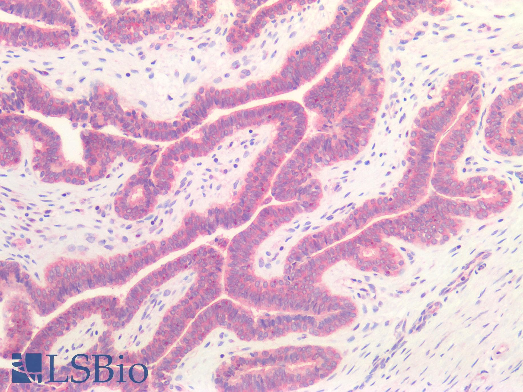 IHC-plus™ Polyclonal Rabbit anti-Human HGF / Hepatocyte Growth Factor Antibody (IHC)