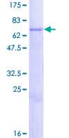 Human CHST12 Protein (Recombinant GST)